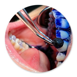 Dentalhygiene Patricia Ried | Kurs 3