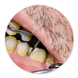 Dentalhygiene Patricia Ried | Kurs 3