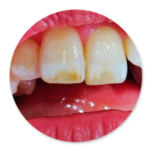 Dentalhygiene Patricia Ried | Kurs 1