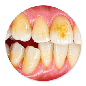 Dentalhygiene Patricia Ried | Kurs 1