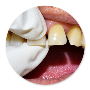 Dentalhygiene Patricia Ried | Kurs 6