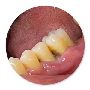 Dentalhygiene Patricia Ried | Kurs 6