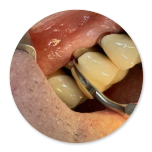 Dentalhygiene Patricia Ried | Kurs 9